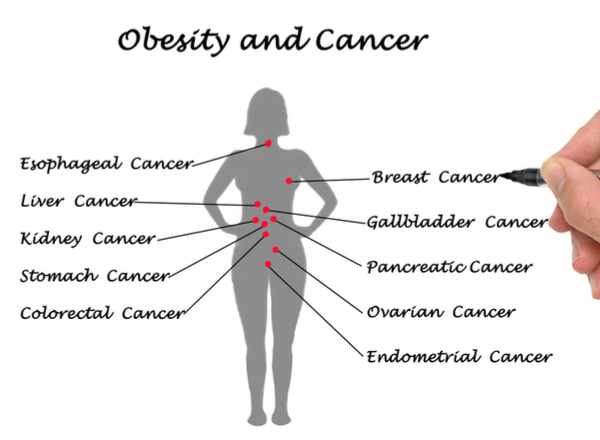 Συσχέτιση της παχυσαρκίας με την καρκινογένεση