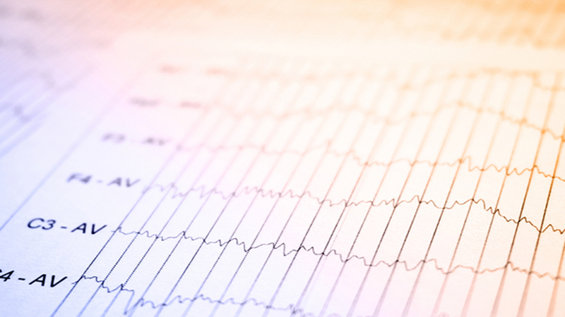 Electrophysiology Laboratory