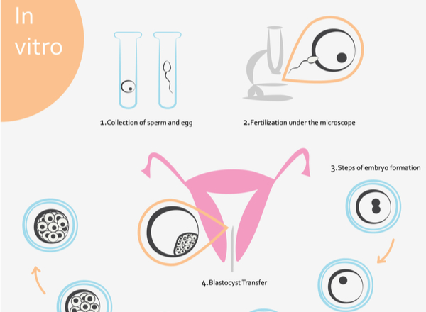 Modern IVF Protocols