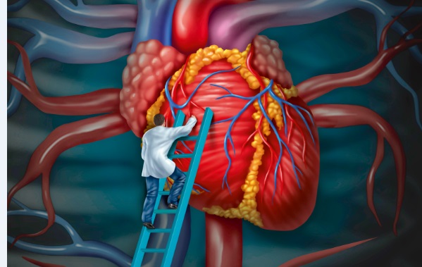 Διακαθετηριακή εμφύτευση καρδιακών βαλβίδων (TAVI) χωρίς ανάγκη χειρουργικής επέμβασης
